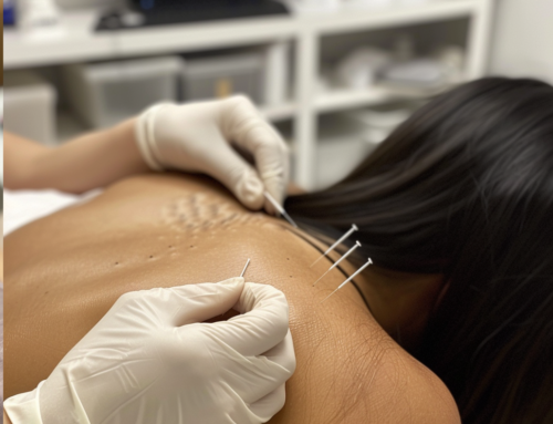 What is Dry Needling used for?